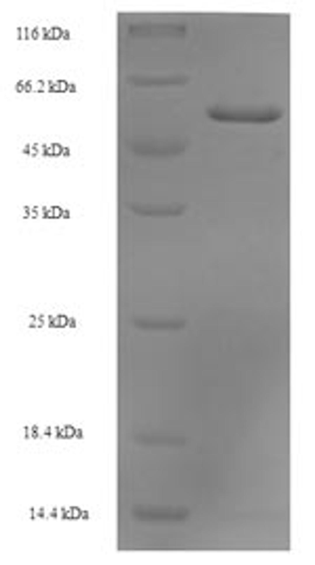 (Tris-Glycine gel) Discontinuous SDS-PAGE (reduced) with 5% enrichment gel and 15% separation gel.