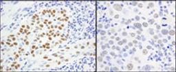 Detection of human and mouse MCM5 by immunohistochemistry.