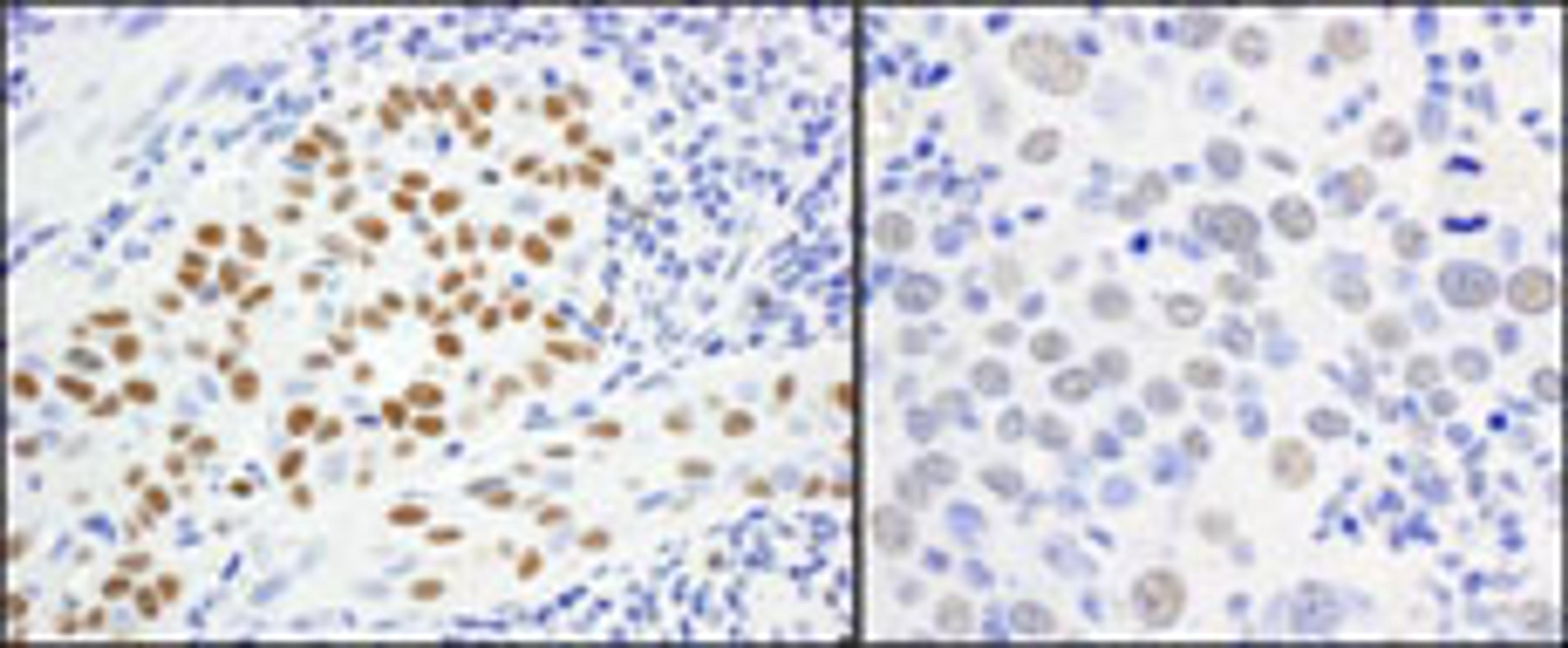 Detection of human and mouse MCM5 by immunohistochemistry.