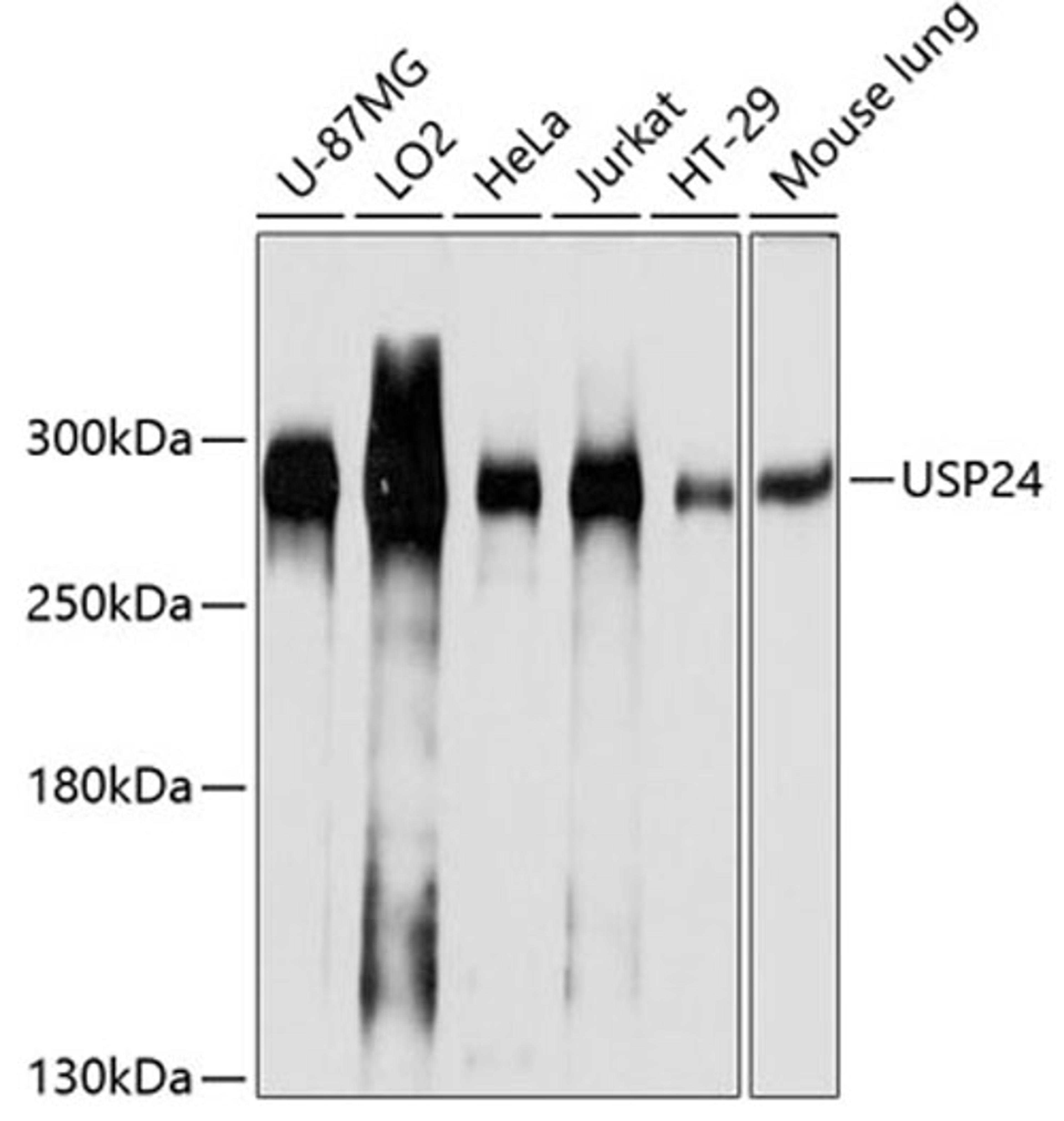 Western blot - USP24 antibody (A10585)