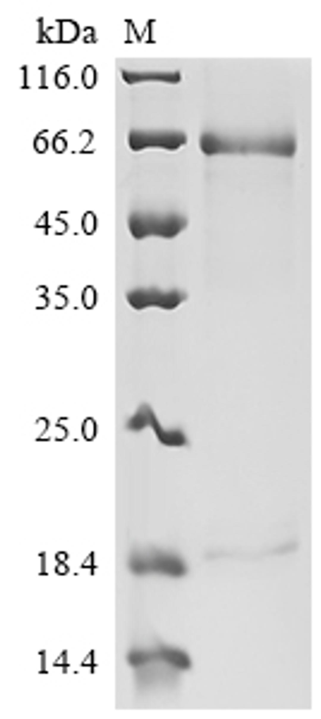 (Tris-Glycine gel) Discontinuous SDS-PAGE (reduced) with 5% enrichment gel and 15% separation gel.