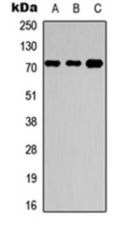 Western blot analysis of HEK293T (Lane 1), Raw264.7 (Lane 2), H9C2 (Lane 3) whole cell lysates using NBPF4/6 antibody