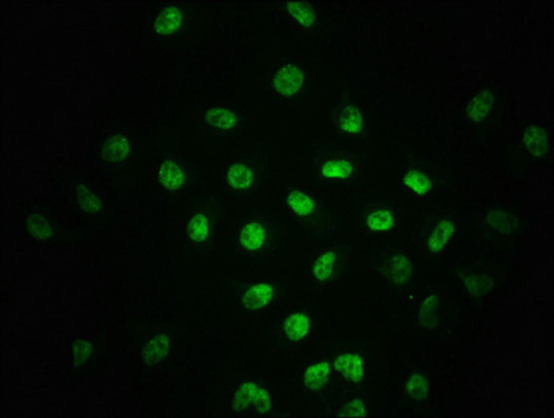 Immunofluorescence staining of A549 cells with CSB-RA618017A255phHU at 1:100,counter-stained with DAPI. The cells were fixed in 4% formaldehyde, permeabilized using 0.2% Triton X-100 and blocked in 10% normal Goat Serum. The cells were then incubated with the antibody overnight at 4℃. The secondary antibody was Alexa Fluor 488-congugated AffiniPure Goat Anti-Rabbit IgG (H+L).