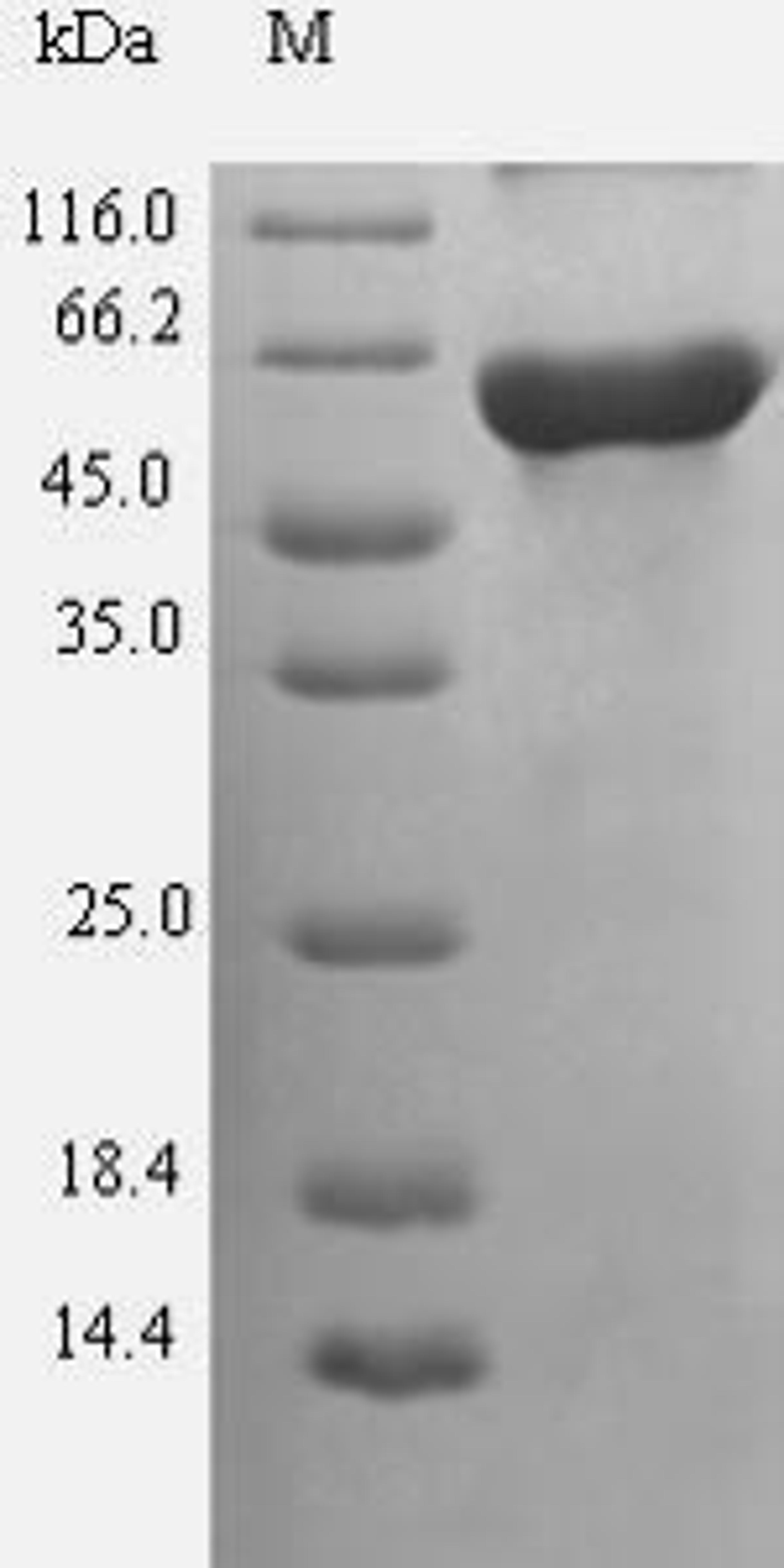 (Tris-Glycine gel) Discontinuous SDS-PAGE (reduced) with 5% enrichment gel and 15% separation gel.