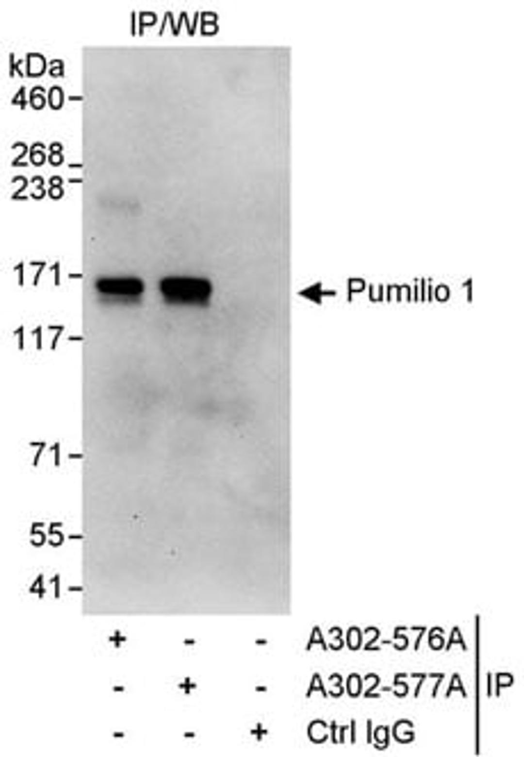 Detection of human Pumilio 1 by western blot of immunoprecipitates.