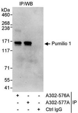 Detection of human Pumilio 1 by western blot of immunoprecipitates.