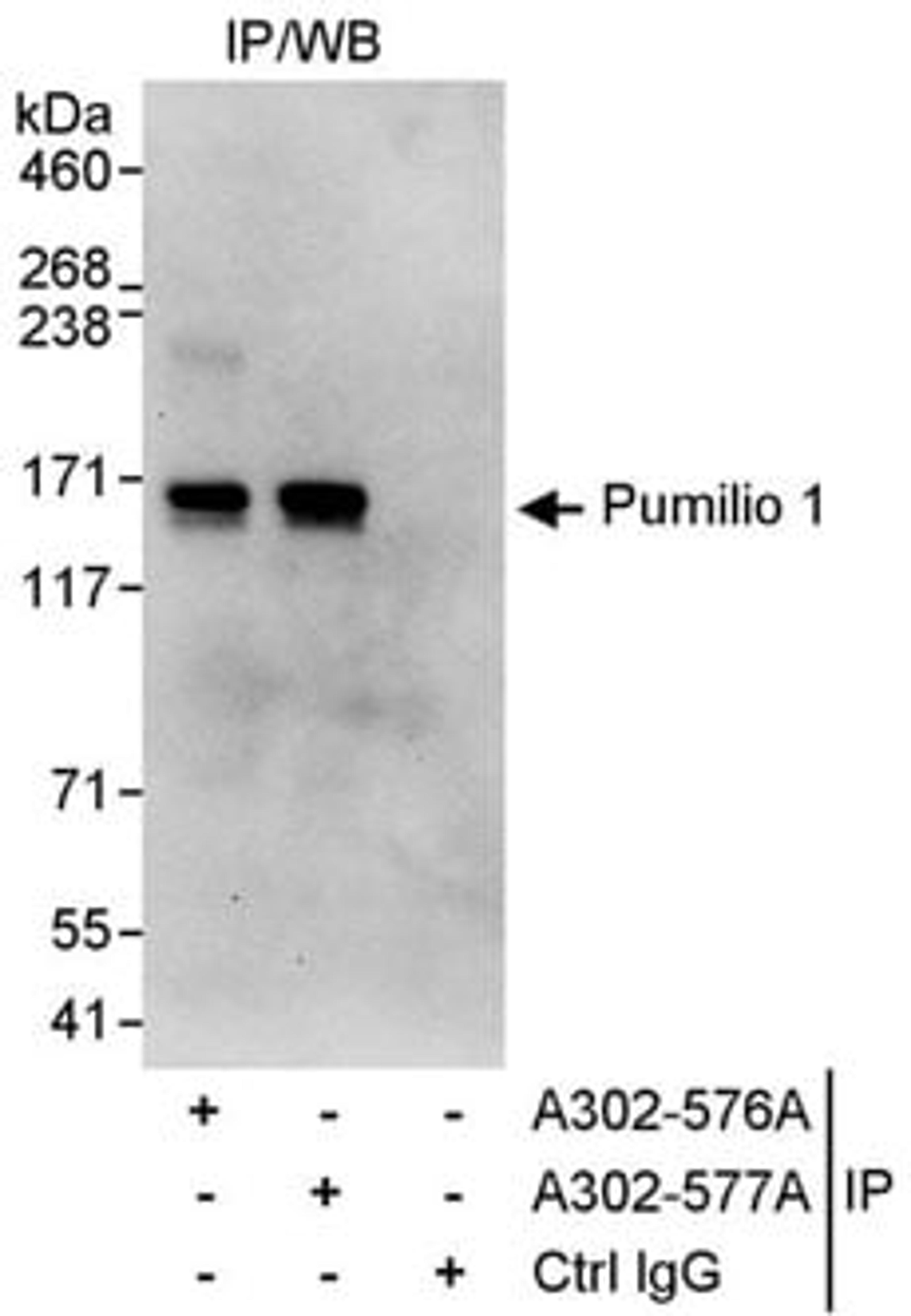 Detection of human Pumilio 1 by western blot of immunoprecipitates.