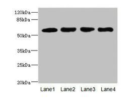 Western blot. All lanes: IL21R antibody at 2.18ug/ml. Lane 1: A549 whole cell lysate. Lane 2: Raji whole cell lysate. Lane 3: Colo320 whole cell lysate. Lane 4: K562 whole cell lysate. Secondary. Goat polyclonal to rabbit IgG at 1/10000 dilution. Predicted band size: 59 kDa. Observed band size: 59 kDa. 
