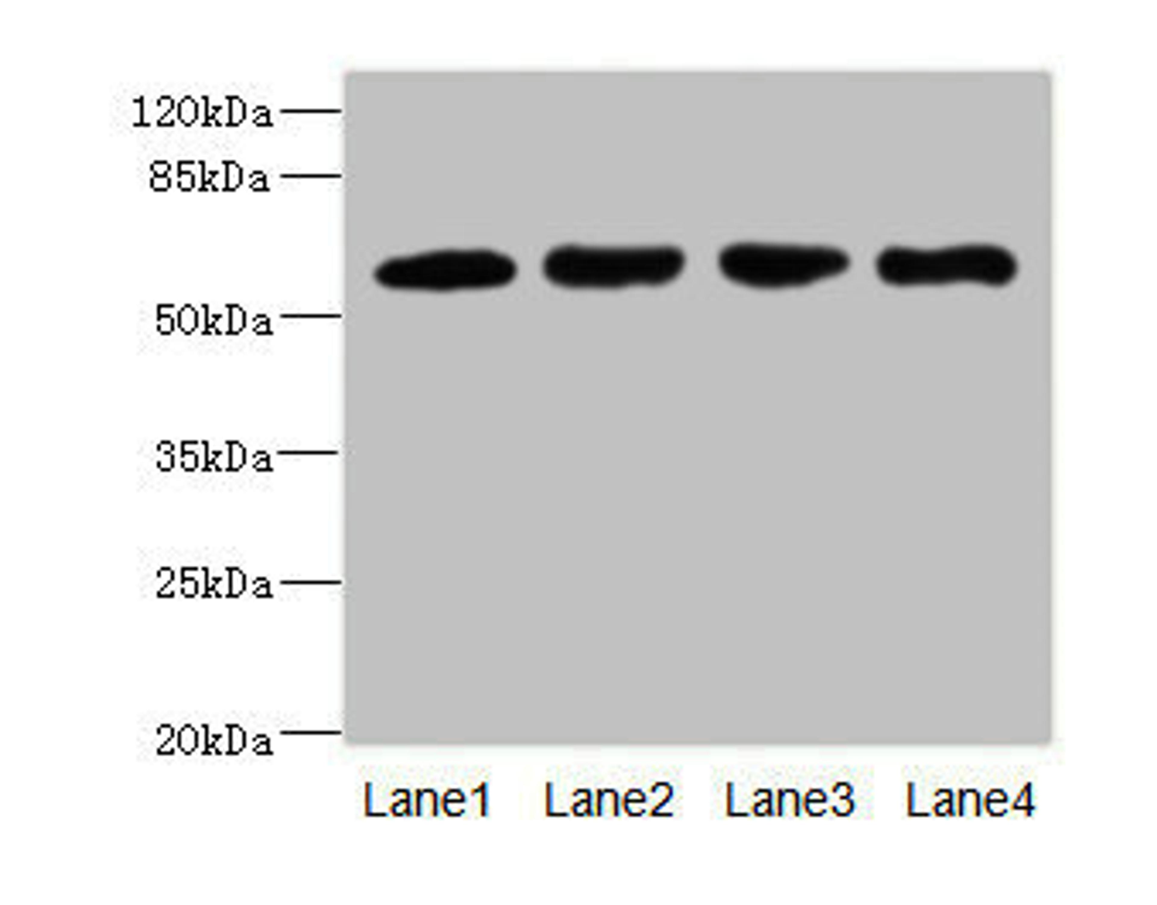 Western blot. All lanes: IL21R antibody at 2.18ug/ml. Lane 1: A549 whole cell lysate. Lane 2: Raji whole cell lysate. Lane 3: Colo320 whole cell lysate. Lane 4: K562 whole cell lysate. Secondary. Goat polyclonal to rabbit IgG at 1/10000 dilution. Predicted band size: 59 kDa. Observed band size: 59 kDa. 