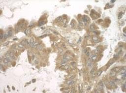 Detection of human SND1 by immunohistochemistry.