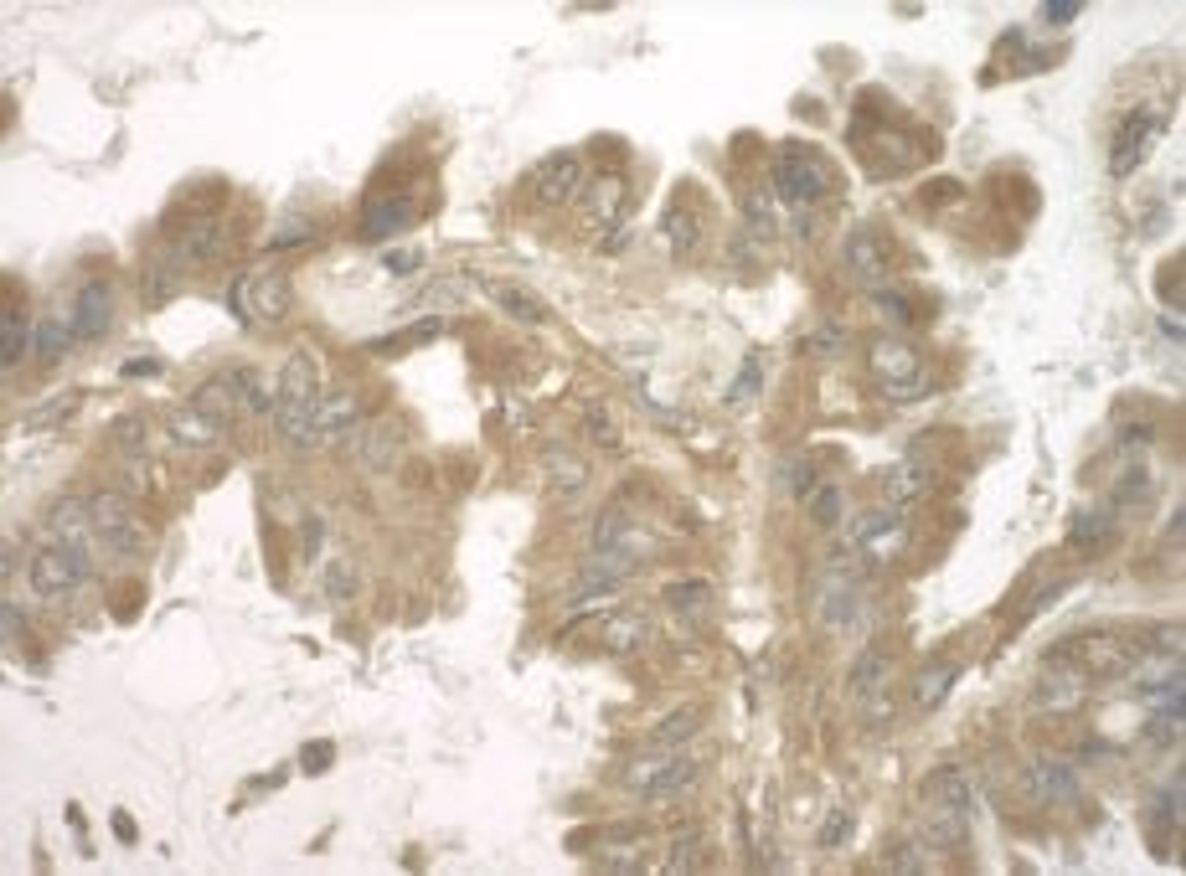 Detection of human SND1 by immunohistochemistry.