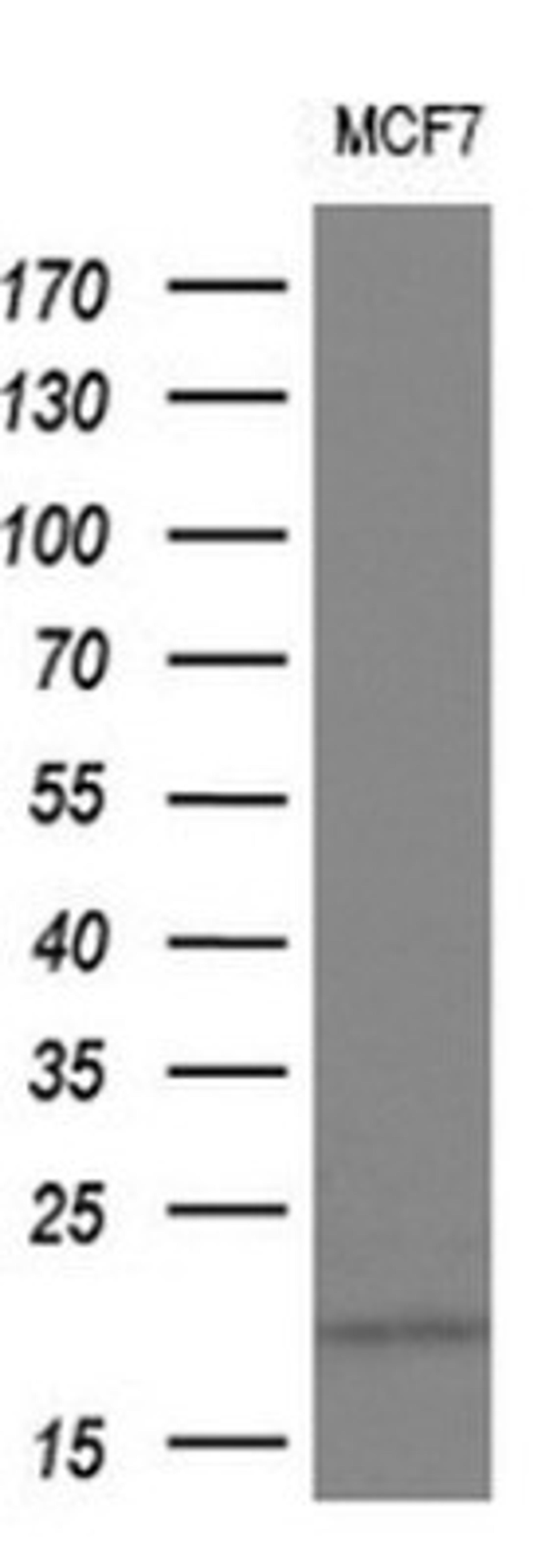 Western Blot: IL1F9 Antibody (2F4) [NBP2-45749] - Analysis of extracts (10ug).