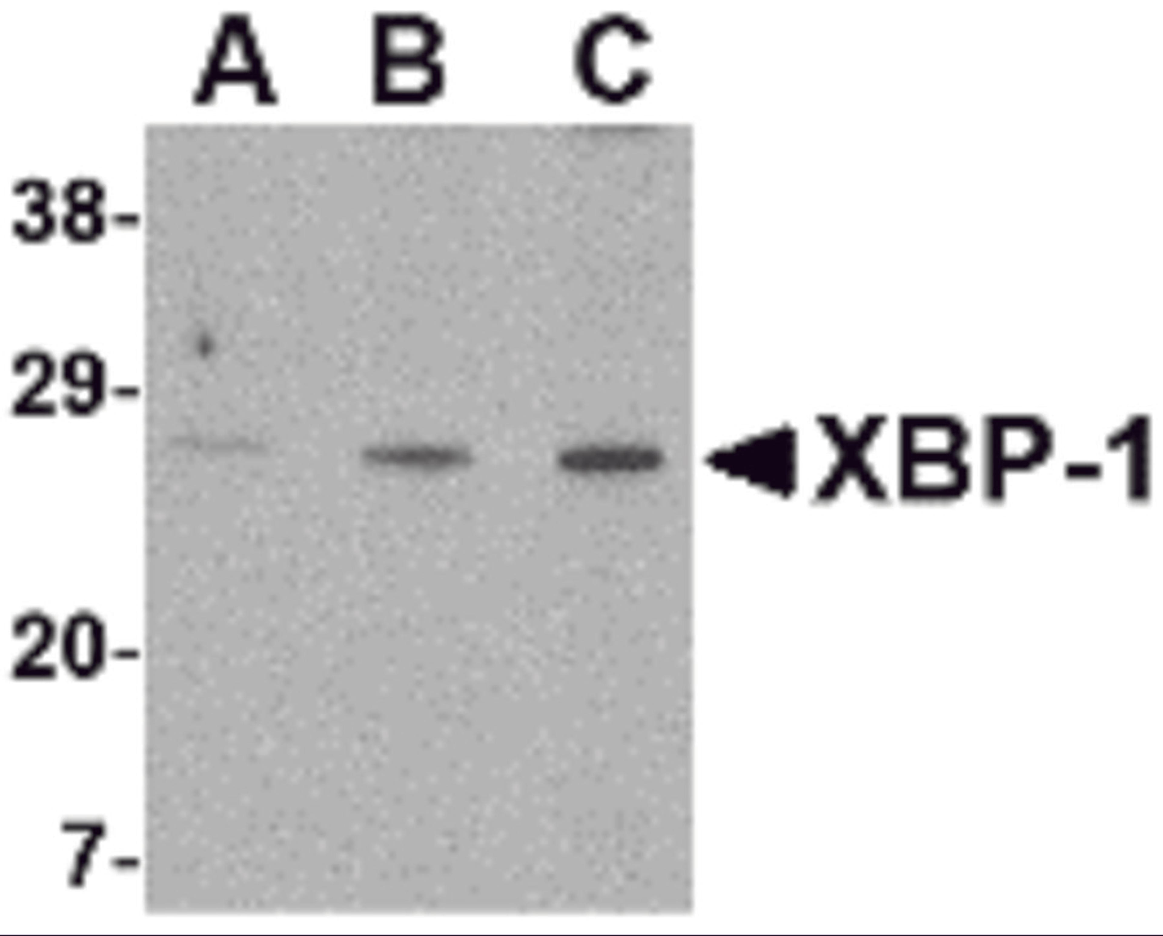 Western blot analysis of XBP-1 in PC-3 cell lysate with XBP-1 antibody at (A) 0.5, (B) 1 and (C) 2 &#956;g/mL.