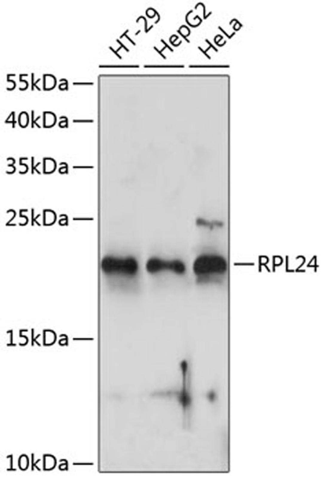 Western blot - RPL24 antibody (A14255)