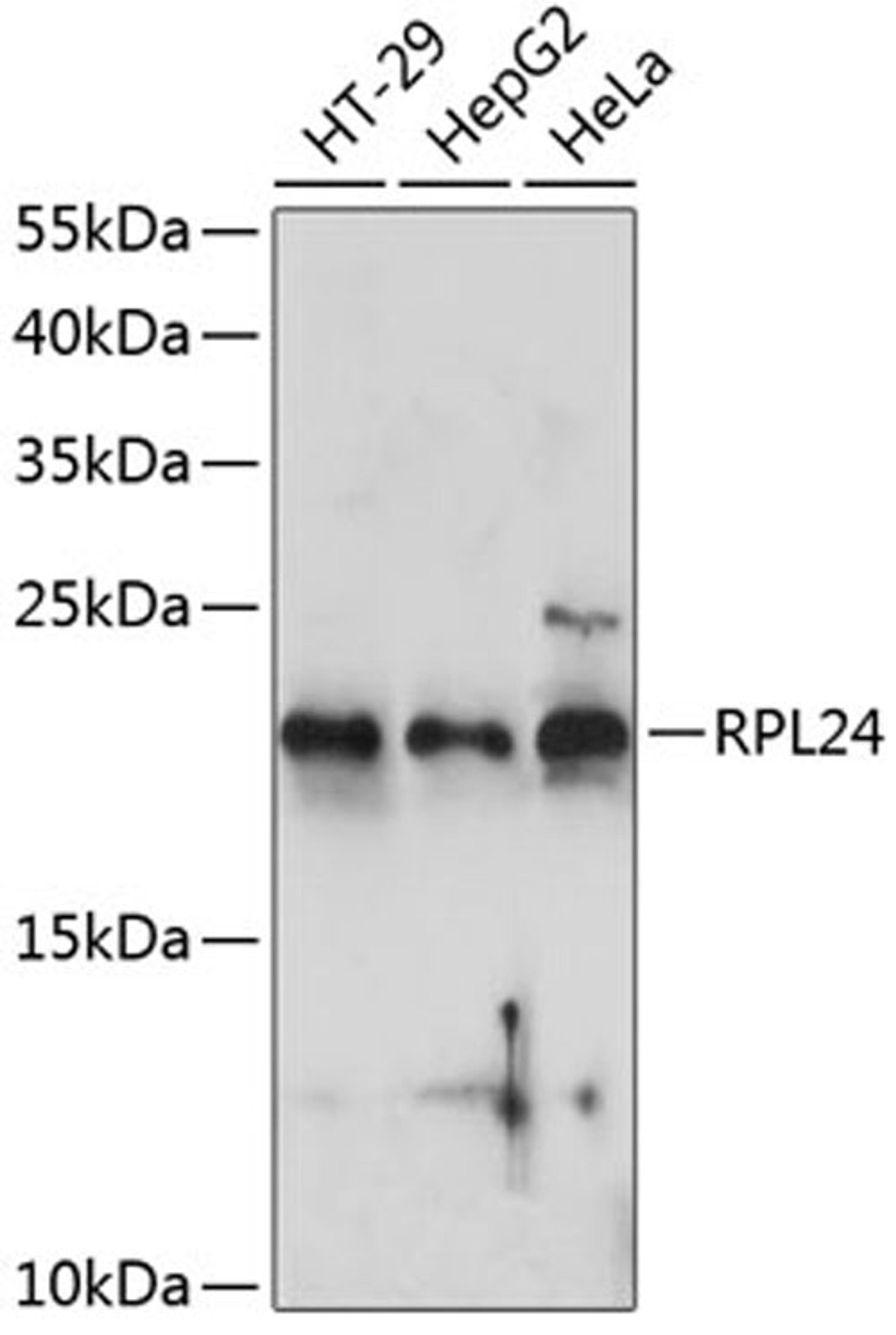 Western blot - RPL24 antibody (A14255)