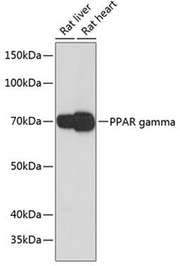 Western blot - PPAR gamma antibody (A19676)