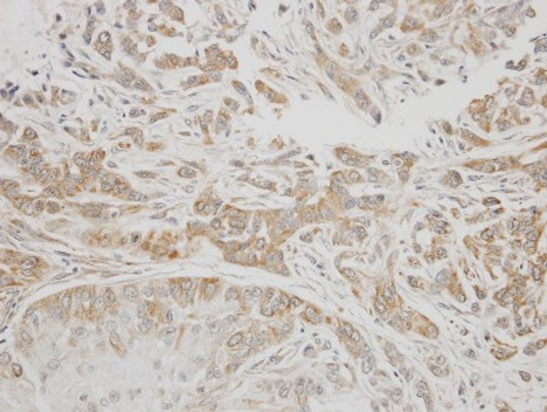 Immunohistochemistry-Paraffin: C1 inhibitor Antibody [NBP1-32478] - Paraffin-embedded A549 xenograft, using antibody at 1:300 dilution.