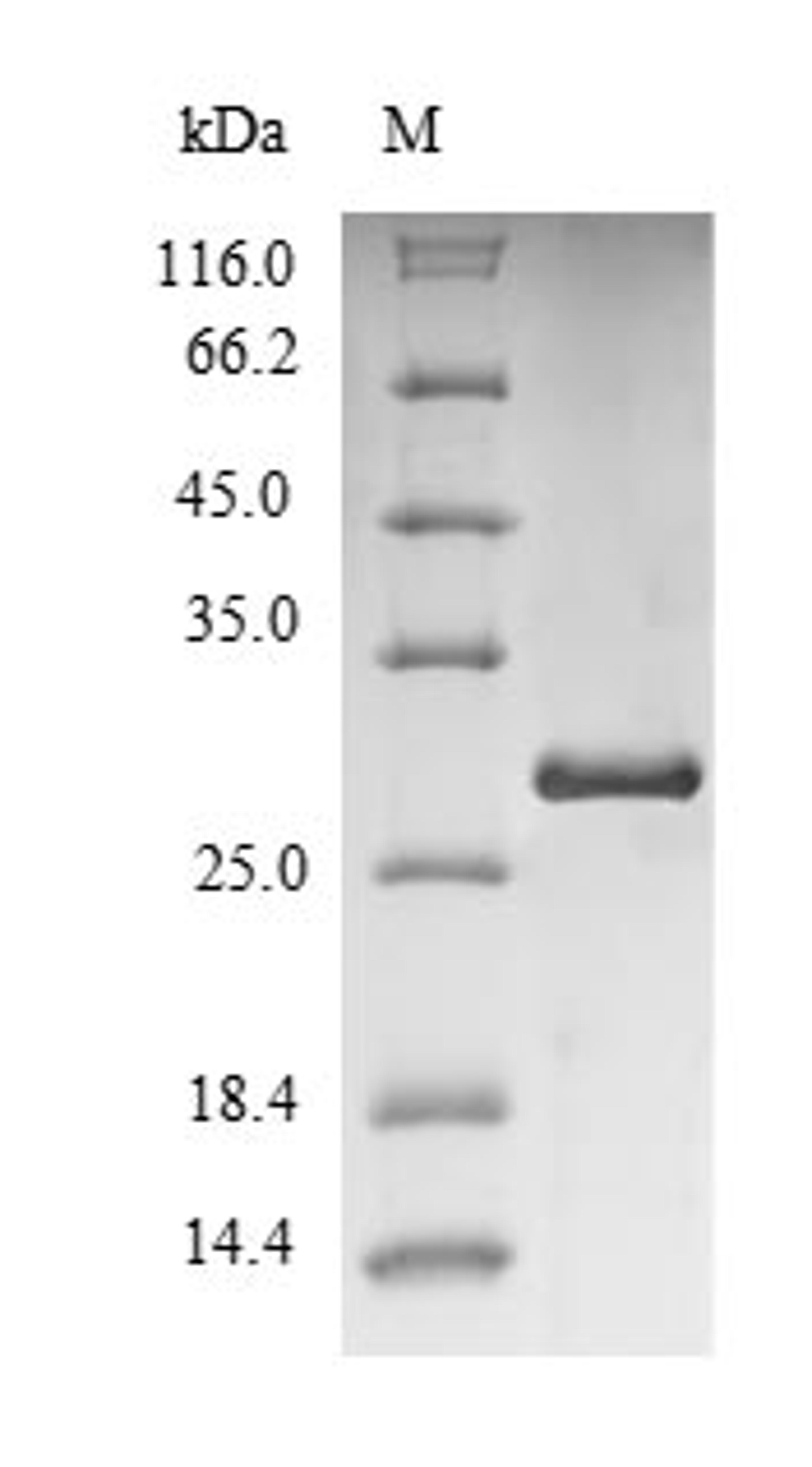 (Tris-Glycine gel) Discontinuous SDS-PAGE (reduced) with 5% enrichment gel and 15% separation gel.