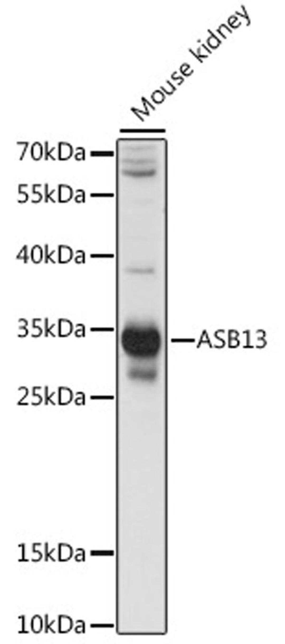 Western blot - ASB13 antibody (A15897)