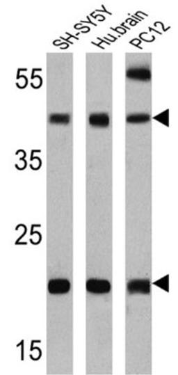 Western Blot: Presenilin-2 Antibody (APS 21) [NB100-74512] - Analysis of 25 ug of SH-SY5Y (lane 1), human brain (lane 2) and PC12 (lane 3).