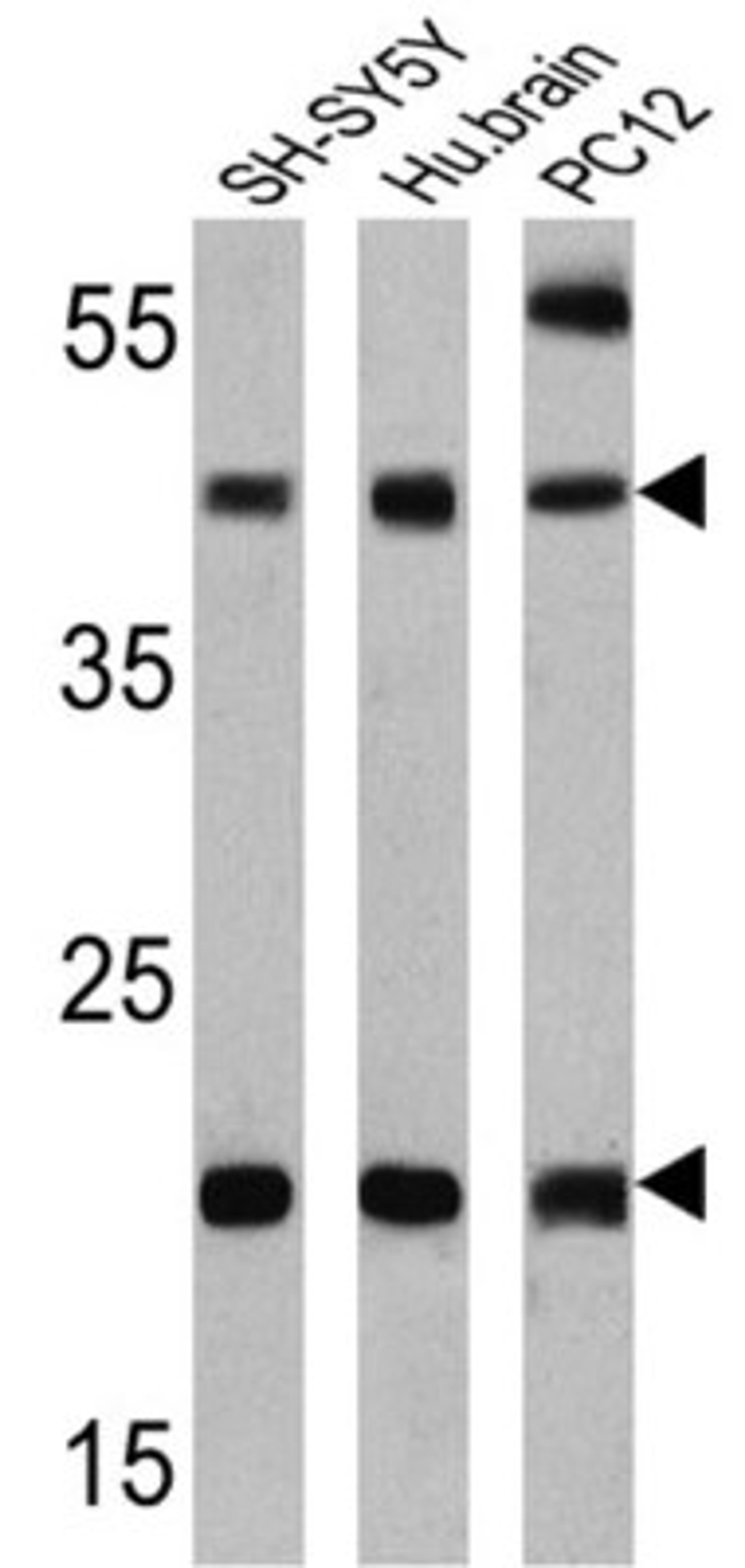 Western Blot: Presenilin-2 Antibody (APS 21) [NB100-74512] - Analysis of 25 ug of SH-SY5Y (lane 1), human brain (lane 2) and PC12 (lane 3).