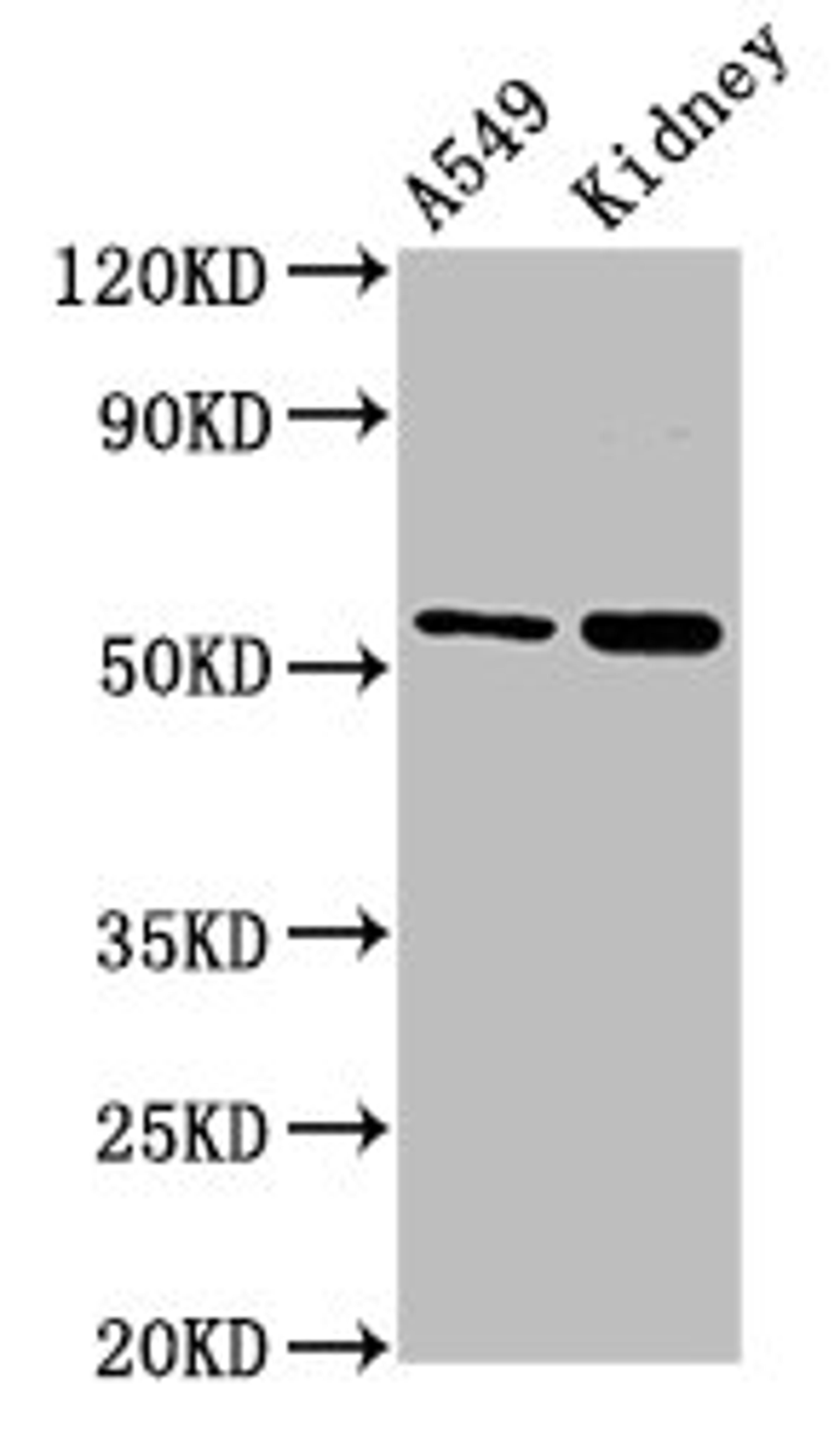 Western Blot. Positive WB detected in: A549 whole cell lysate, Rat kidney tissue. All lanes: AFG1L antibody at 3µg/ml. Secondary. Goat polyclonal to rabbit IgG at 1/50000 dilution. Predicted band size: 55 kDa. Observed band size: 55 kDa