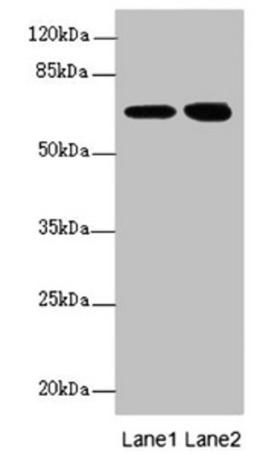 Western blot. All lanes: EYA3 antibody at 2.88ug/ml. Lane 1: Hela whole cell lysate. Lane 2: 293T whole cell lysate. Secondary. Goat polyclonal to rabbit IgG at 1/10000 dilution. Predicted band size: 63, 49, 59, 57, 58 kDa. Observed band size: 63, 67 kDa. 