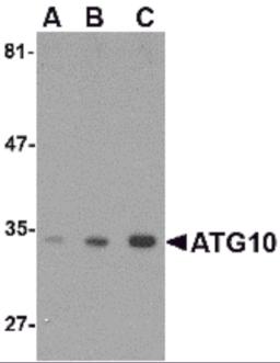 Western blot analysis of ATG10 in SK-N-SH cell lysate with ATG10 antibody at (A) 0.5, (B) 1 and (C) 2 &#956;g/mL.