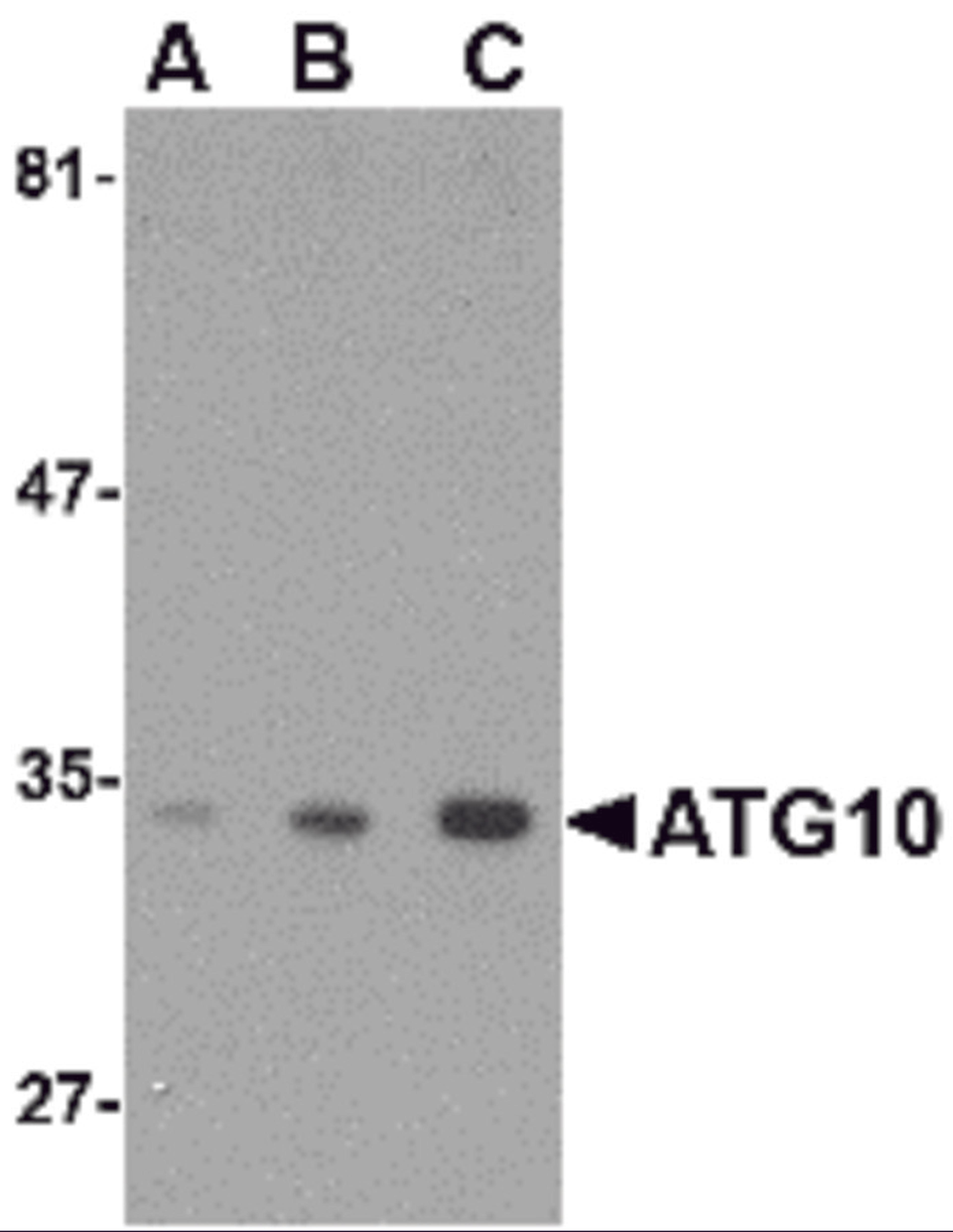 Western blot analysis of ATG10 in SK-N-SH cell lysate with ATG10 antibody at (A) 0.5, (B) 1 and (C) 2 &#956;g/mL.