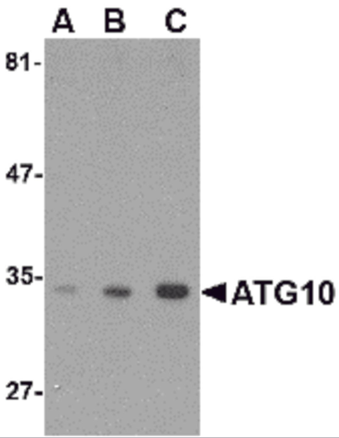 Western blot analysis of ATG10 in SK-N-SH cell lysate with ATG10 antibody at (A) 0.5, (B) 1 and (C) 2 μg/mL.