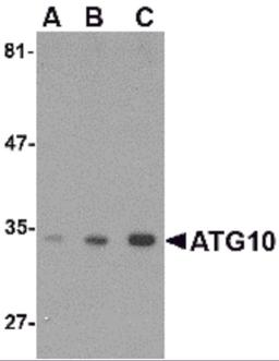 Western blot analysis of ATG10 in SK-N-SH cell lysate with ATG10 antibody at (A) 0.5, (B) 1 and (C) 2 μg/mL.