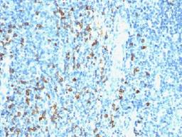 Immunohistochemical staining of human Tonsil tissue using Biotin (Vitamin B7 or Vitamin H) antibody