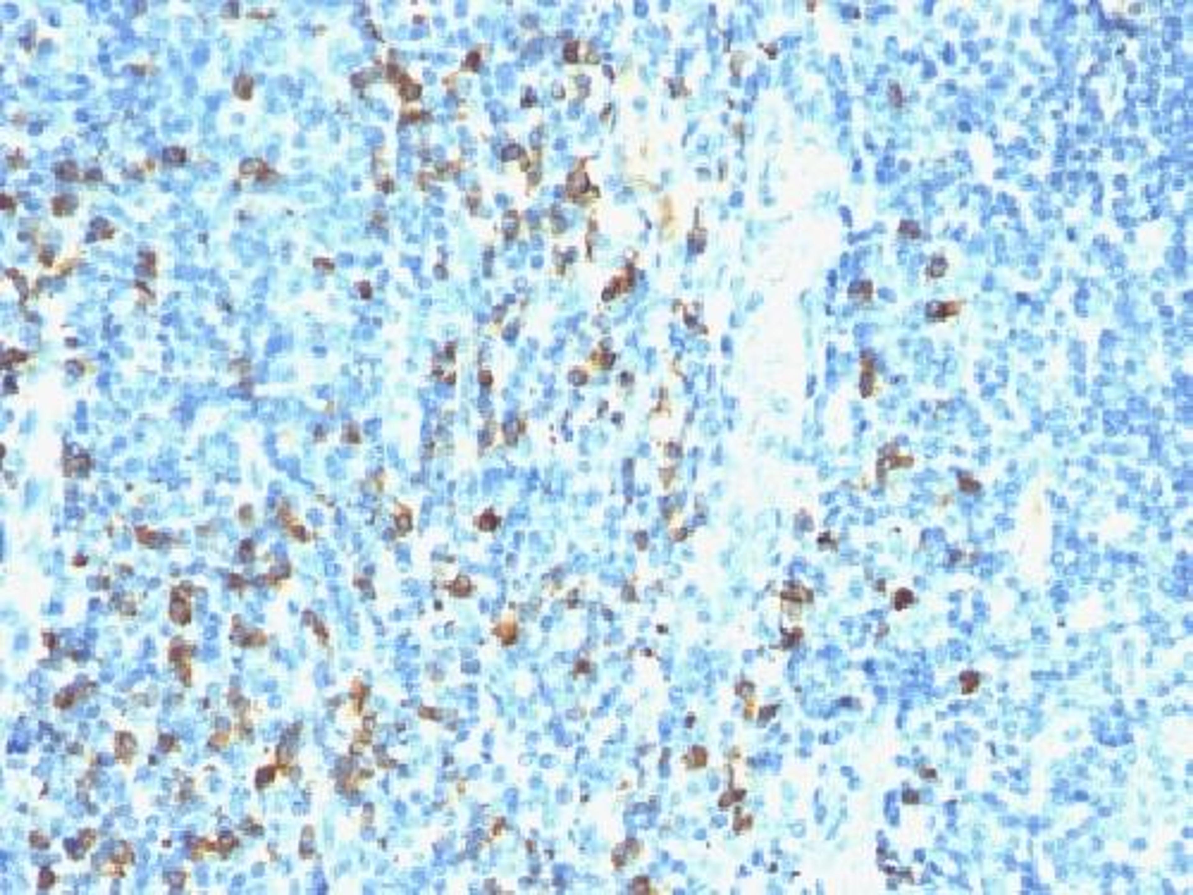 Immunohistochemical staining of human Tonsil tissue using Biotin (Vitamin B7 or Vitamin H) antibody