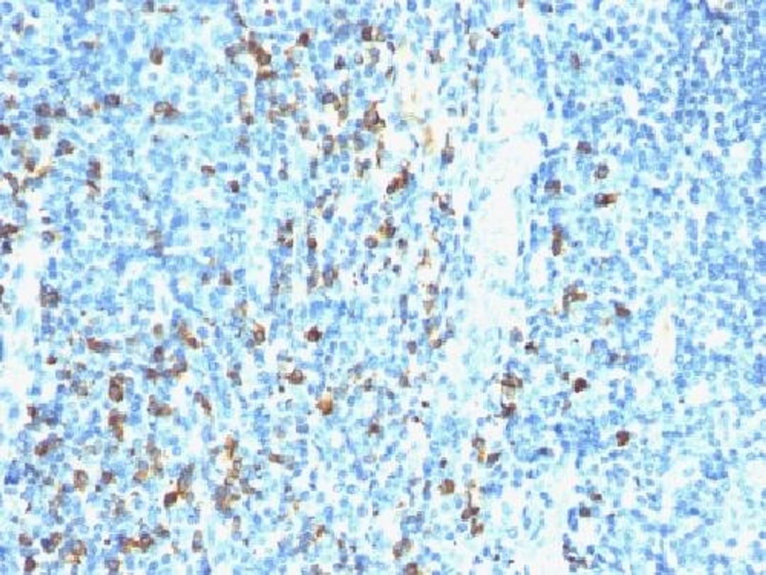 Immunohistochemical staining of human Tonsil tissue using Biotin (Vitamin B7 or Vitamin H) antibody