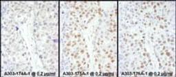 Detection of human HSF1 by immunohistochemistry.