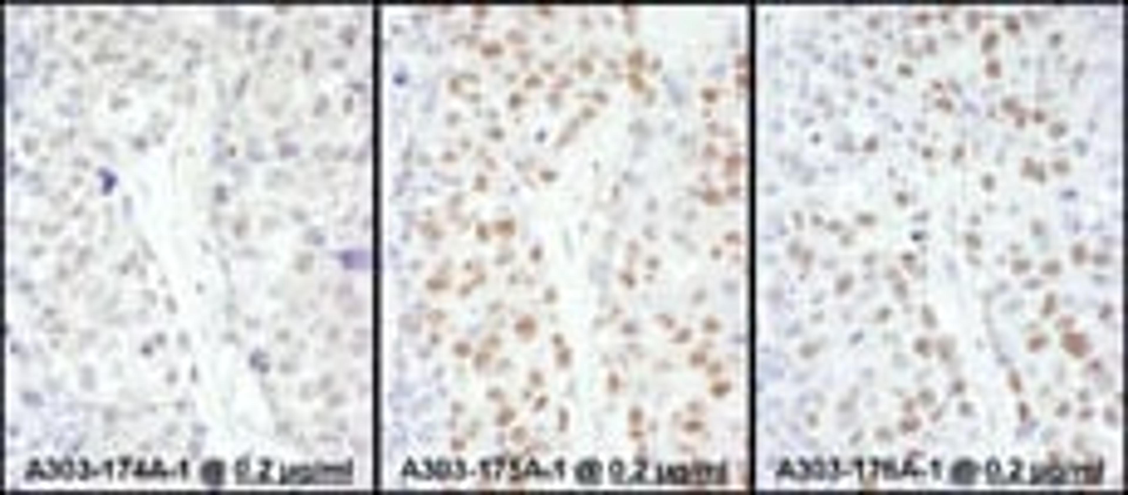 Detection of human HSF1 by immunohistochemistry.