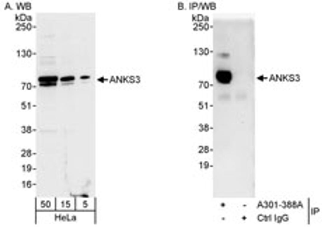 Detection of human ANKS3 by western blot and immunoprecipitation.