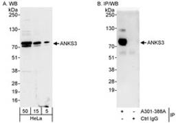 Detection of human ANKS3 by western blot and immunoprecipitation.