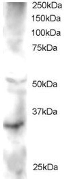 45-633 staining (2ug/ml) of Human Heart lysate (RIPA buffer, 30ug total protein per lane). Primary incubated for 1 hour. Detected by western blot using chemiluminescence.