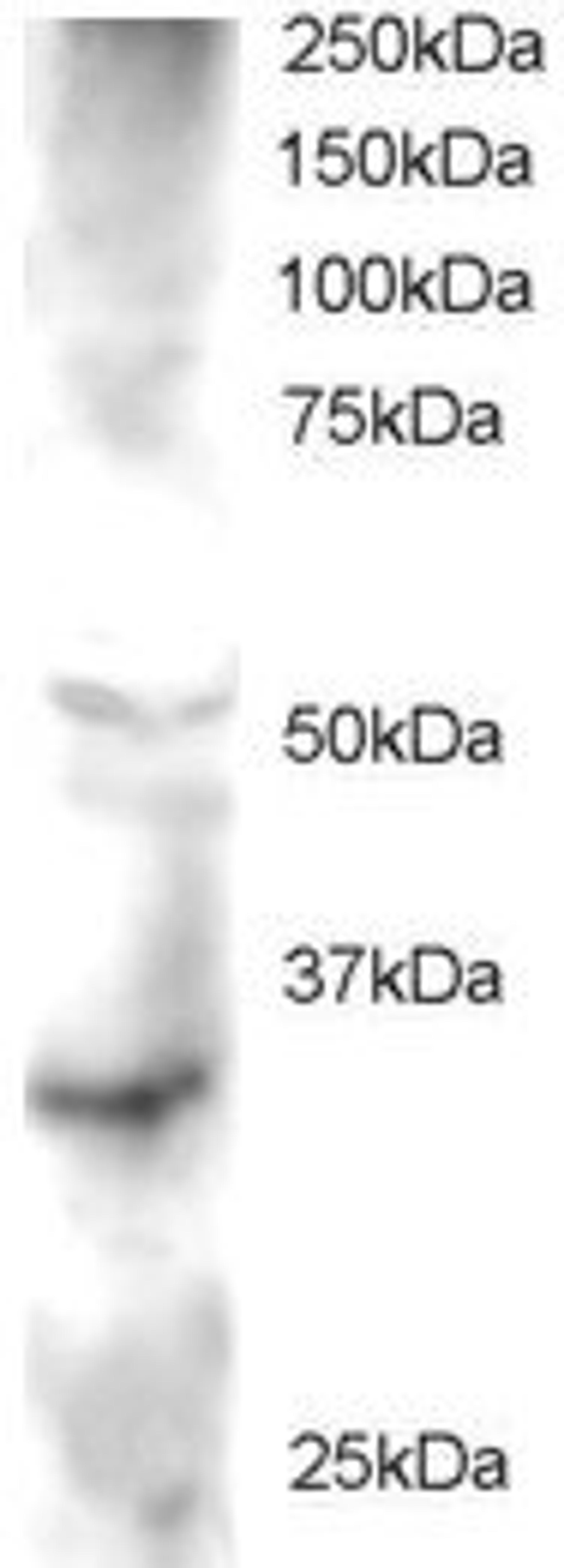 45-633 staining (2ug/ml) of Human Heart lysate (RIPA buffer, 30ug total protein per lane). Primary incubated for 1 hour. Detected by western blot using chemiluminescence.