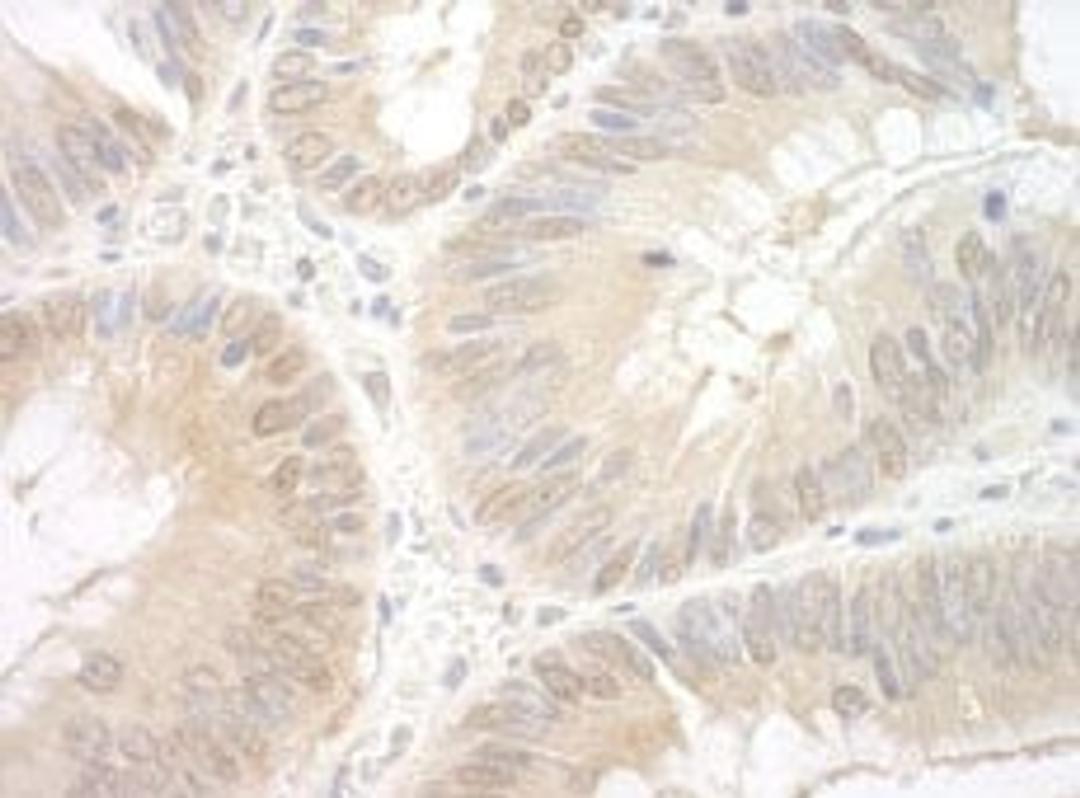 Detection of human EAF2 by immunohistochemistry.