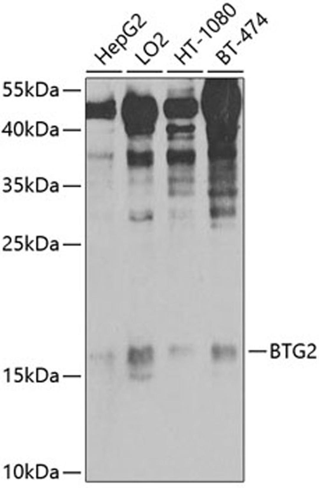 Western blot - BTG2 antibody (A9848)