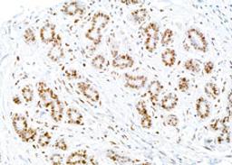 Detection of human PCNA by immunohistochemistry.