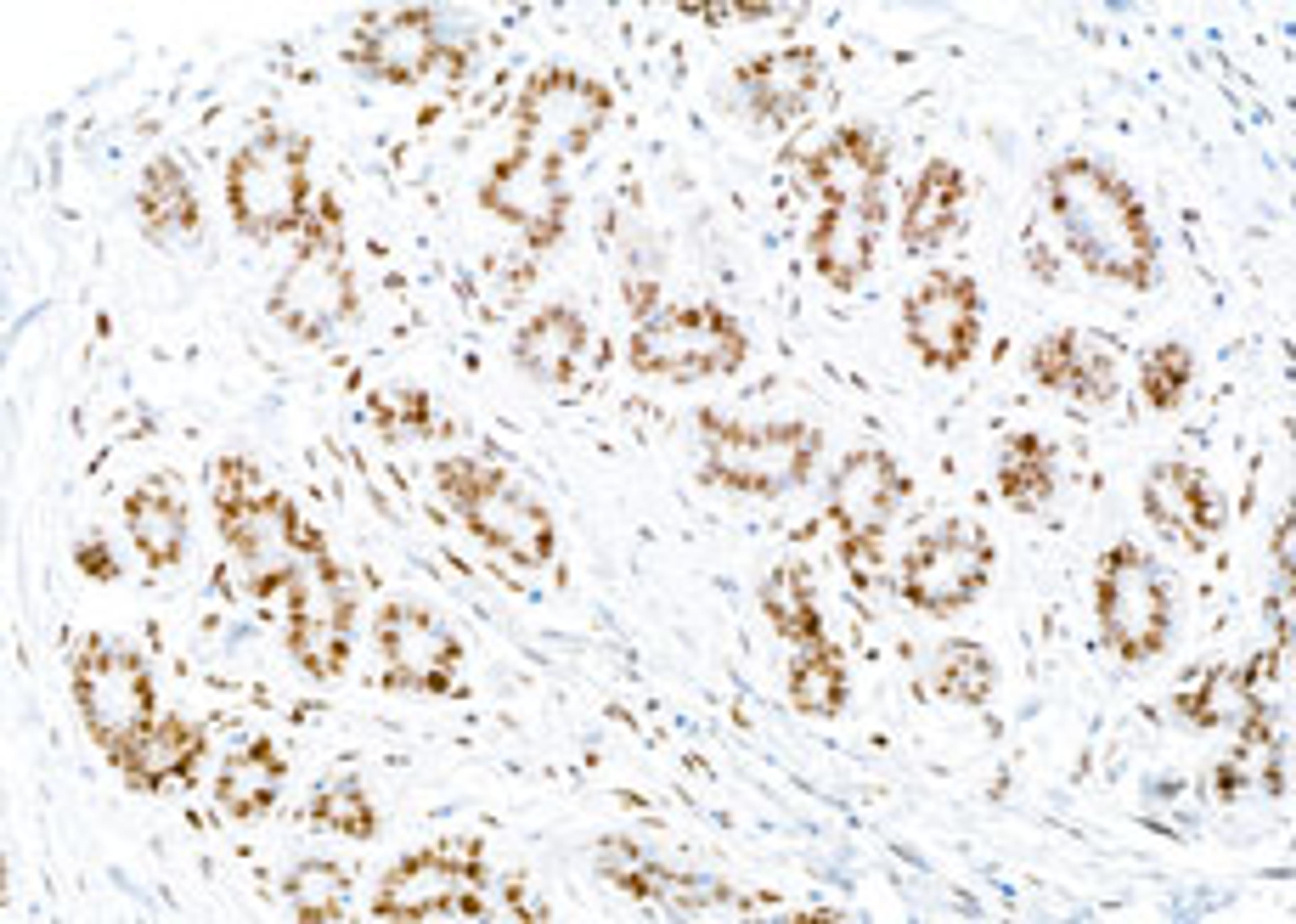 Detection of human PCNA by immunohistochemistry.