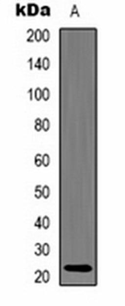 Western blot analysis of 293T (Lane 1) whole cell lysates using Alpha-crystallin C antibody