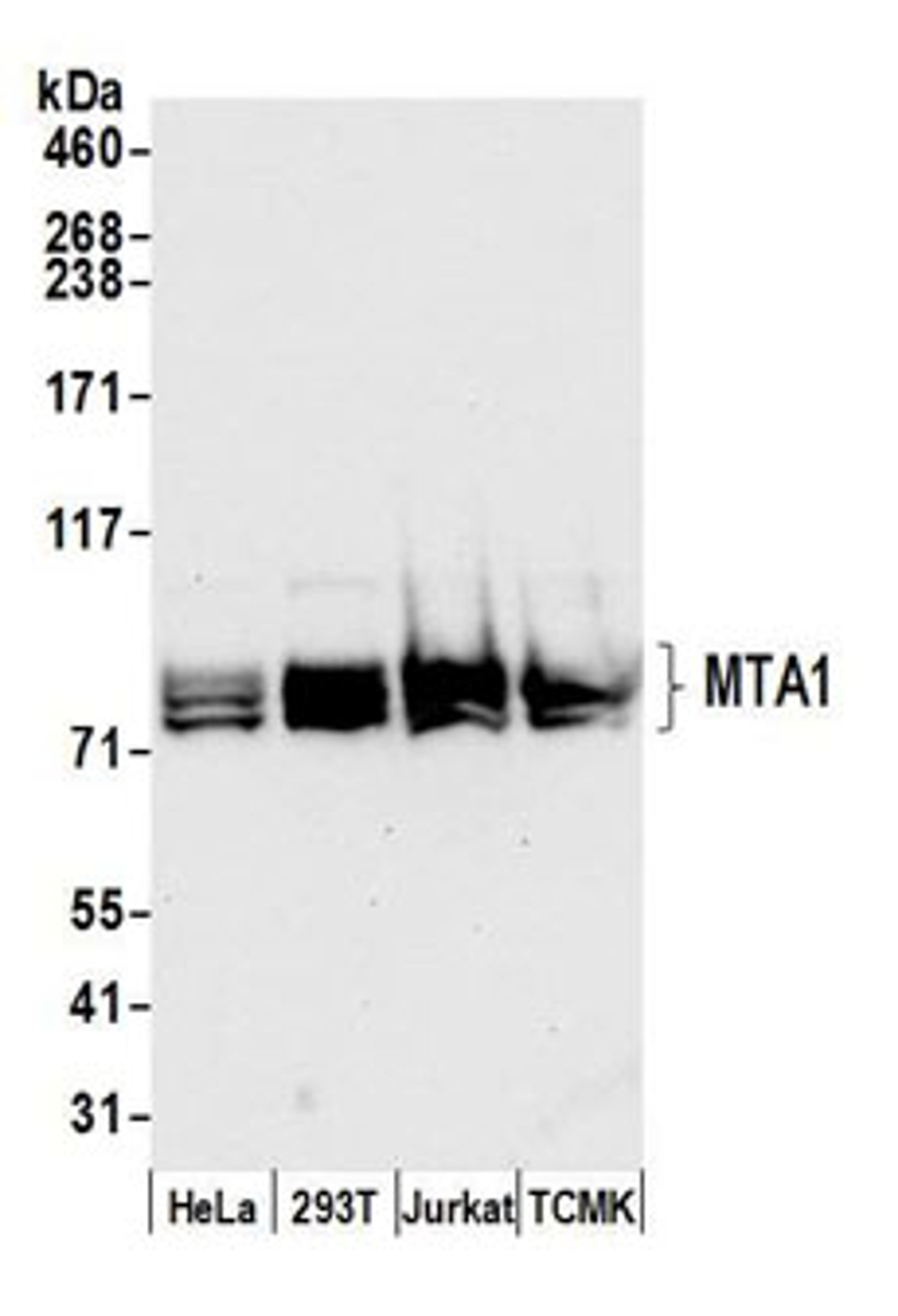 Detection of human and mouse MTA1 by western blot.