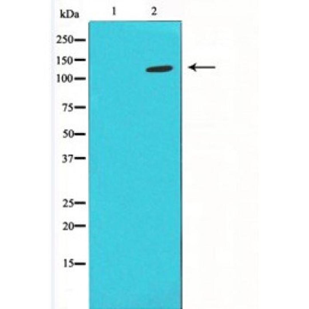 Western blot analysis of (Lane1) Hela, (Lane2)mouse Brain using ErbB-2 antibody