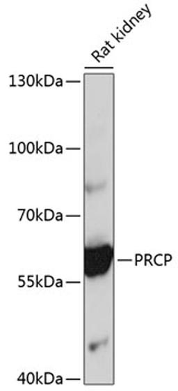 Western blot - PRCP antibody (A4040)