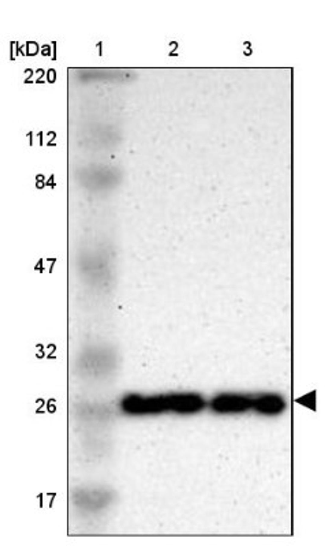 Western Blot: SNRPN Antibody [NBP1-83280] - Lane 1: Marker [kDa] 220, 112, 84, 47, 32, 26, 17<br/>Lane 2: Human cell line RT-4<br/>Lane 3: Human cell line U-251MG sp