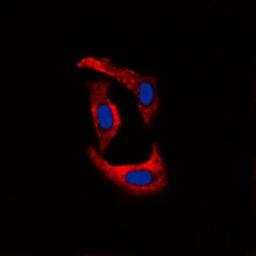 Immunofluorescense analysis of U251 cells using Ryanodine Receptor 2 (phospho-S2808) antibody